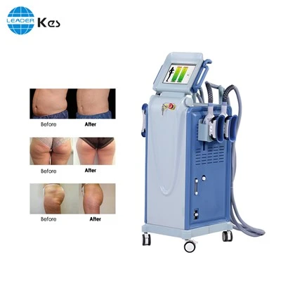 เครื่องลดไขมัน Cryo