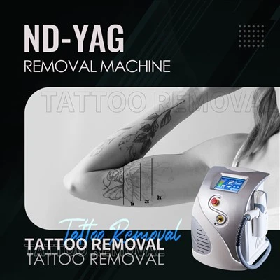 ND: YAG Laser 1064nm Machine Machine